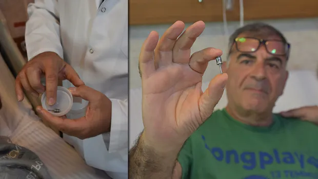 Akciğerinden çıkana inanamadı! Doktorlar şaşkına döndü: Genelde çocuklarda görülüyor, ilginç bir olay