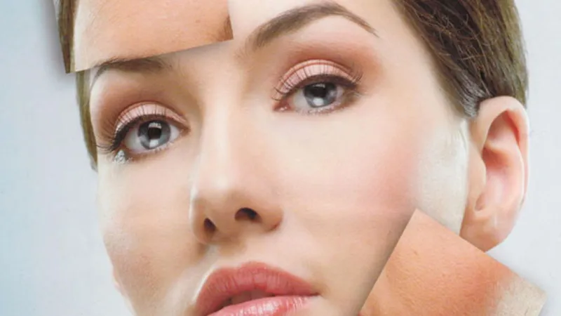 Cildinizi koruyun! Kışın sık rastlanan cilt hastalıkları