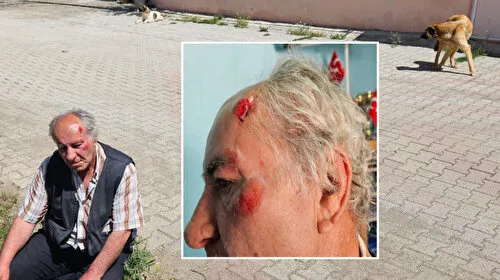 Köpek Dehşeti! Ekmek Almaya Giderken Saldırıya Uğradı!
