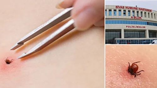 Sivas'ta Kene Kabusu! KKKA'dan Ölüm Sayısı Artıyor